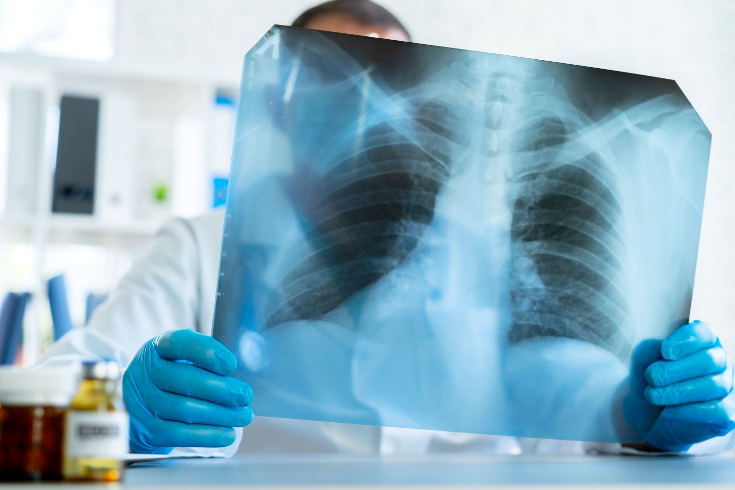 Pneumonia
